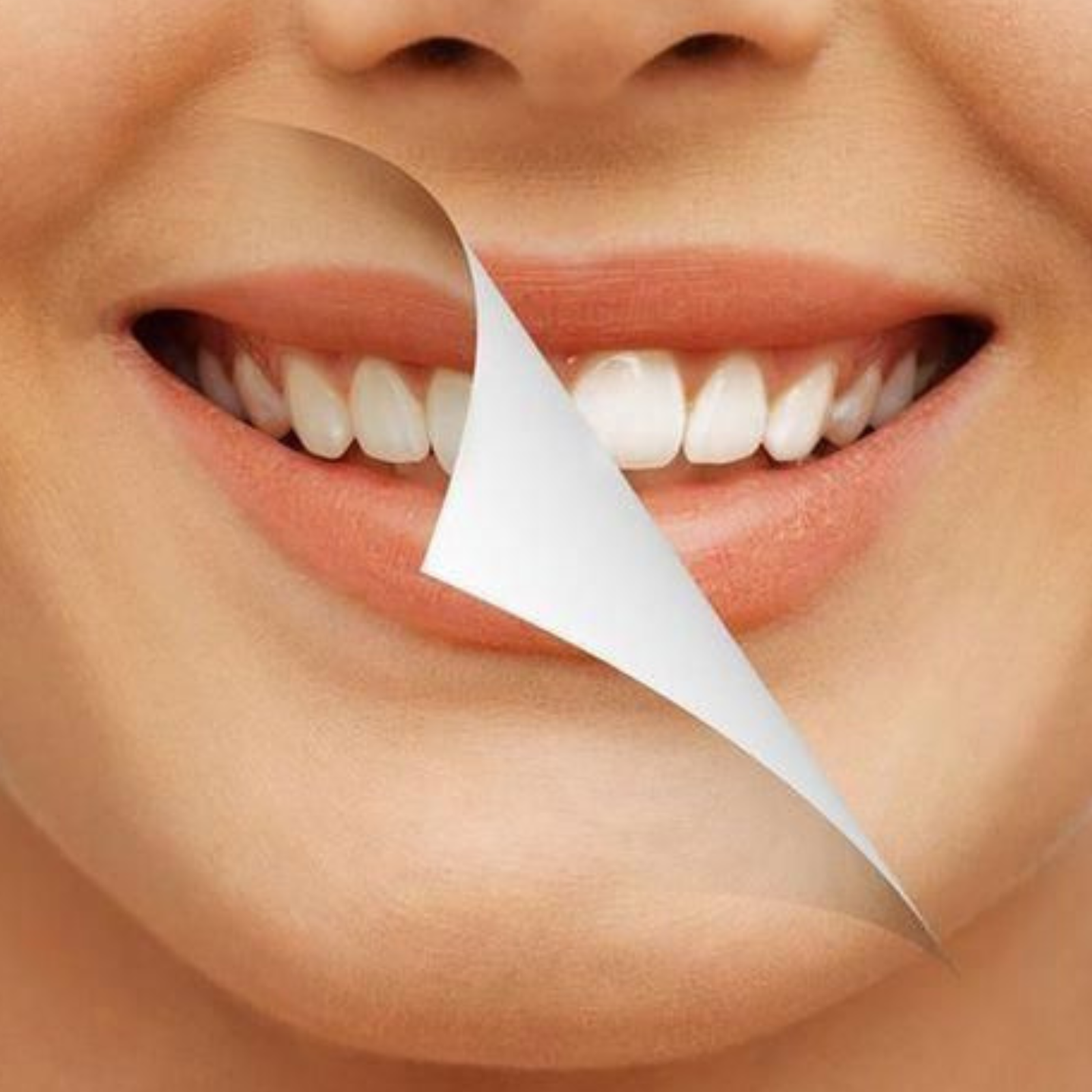 Dents